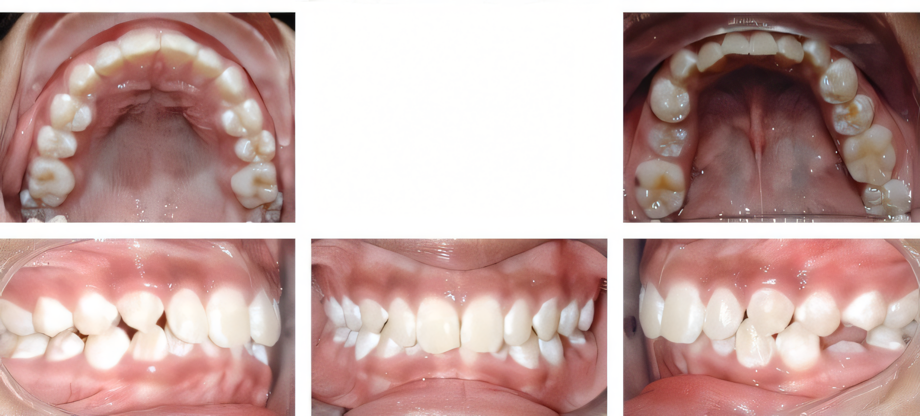 Comprehensive treatment before